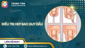 Điều trị hẹp bao quy đầu