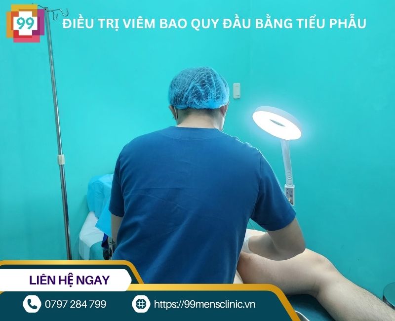 Điều trị viêm bao quy đầu bằng tiểu phẫu