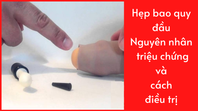 Nguyên nhân và cách điều trị hẹp bao quy đầu