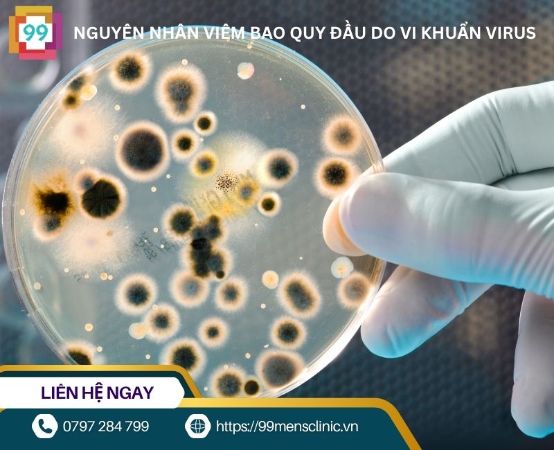 Virus vi khuẩn gây ra viêm nhiễm bao quy đầu