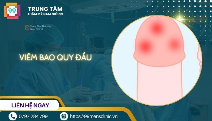 Viêm bao quy đầu