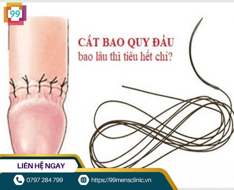 Cắt bao quy đầu bao lâu thì chỉ tự tiêu