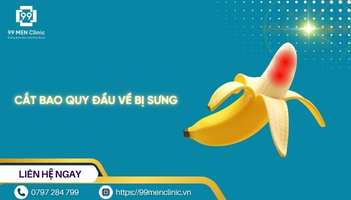 Cắt bao quy đầu về bị sưng