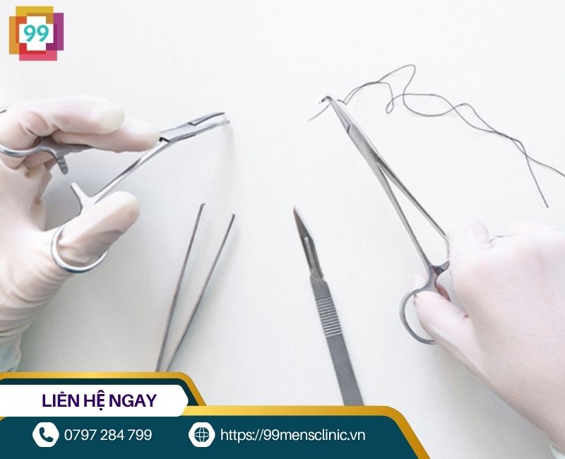 Chỉ tự tiêu trong phẫu thuật cắt da quy đầu