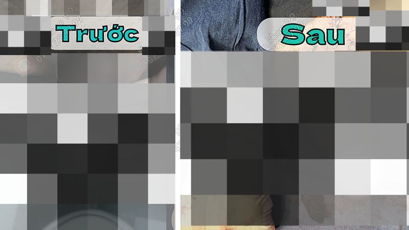 Kết quả phẫu thuật dương vật do phòng khám Nam Khoa 99 thực hiện