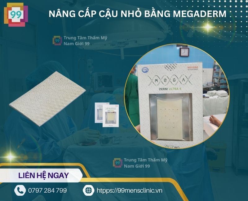 Nâng cấp cậu nhỏ bằng megaderm