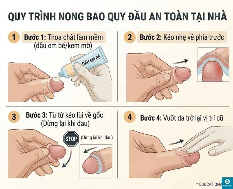 Quy trình nong bao quy đầu tại nhà