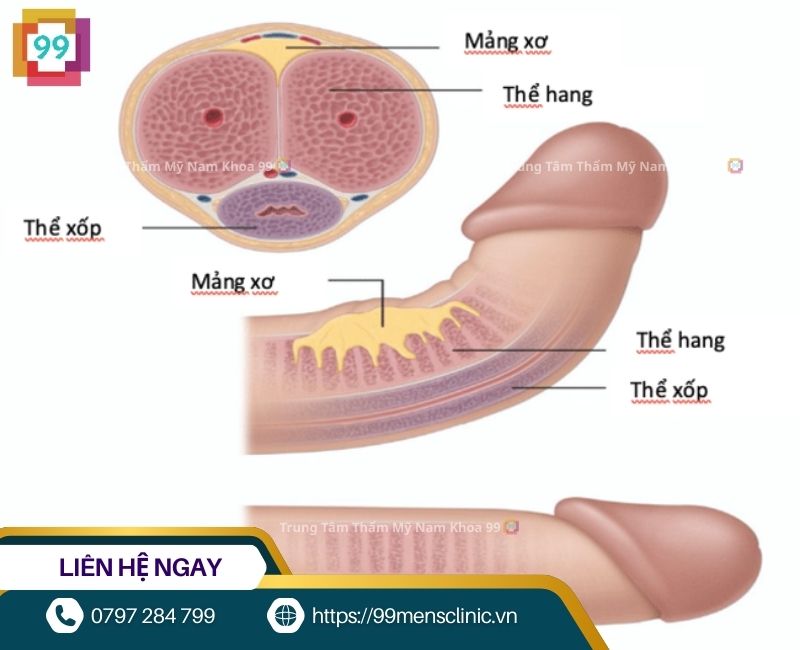 Nguyên nhân dương vật bị cong