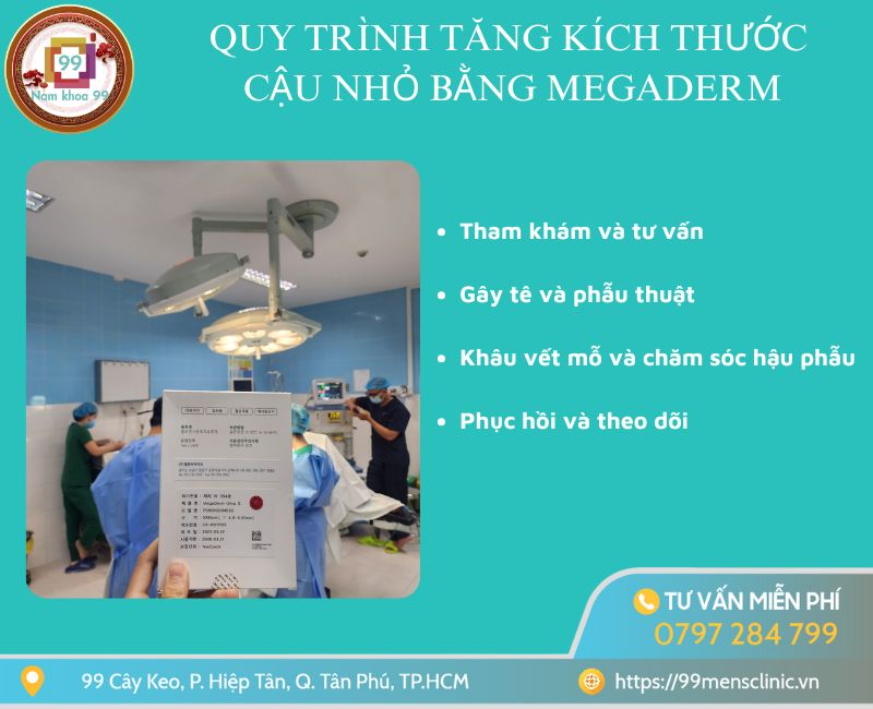 Quy trình tăng kích thước bằng miếng độn megaderm