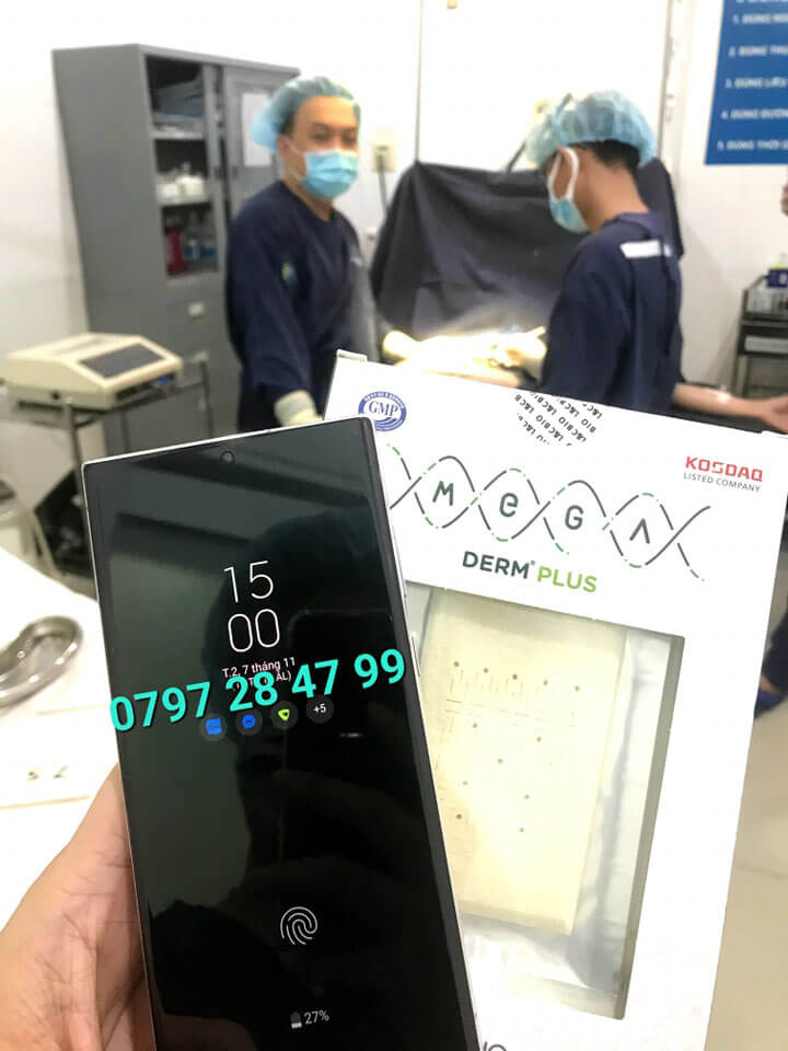 Tấm độn sinh học ADM