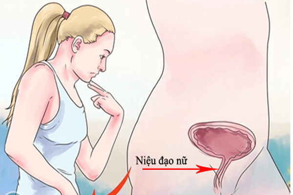 Bệnh viêm niệu đạo có tự khỏi được hay không 1