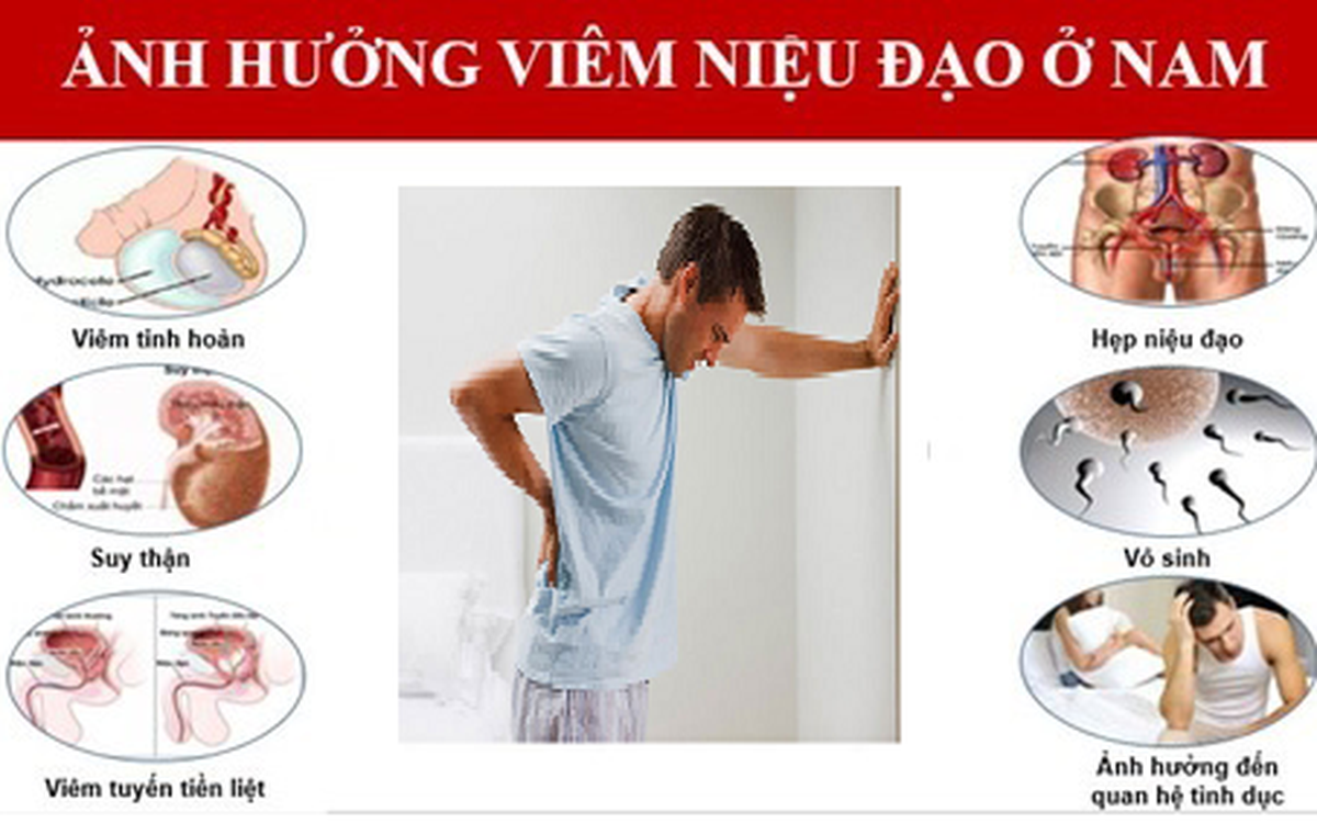 Viêm niệu đạo có thực sự nguy hiểm Những điều cần biết để phòng tránh 2