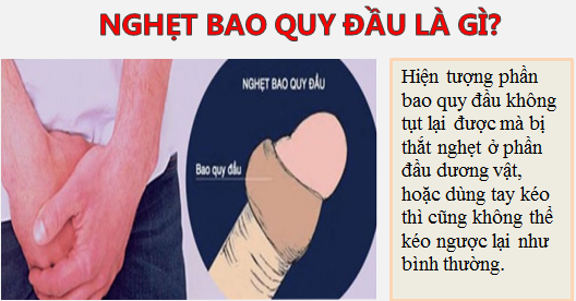 nghẹt bao quy đầu là gì