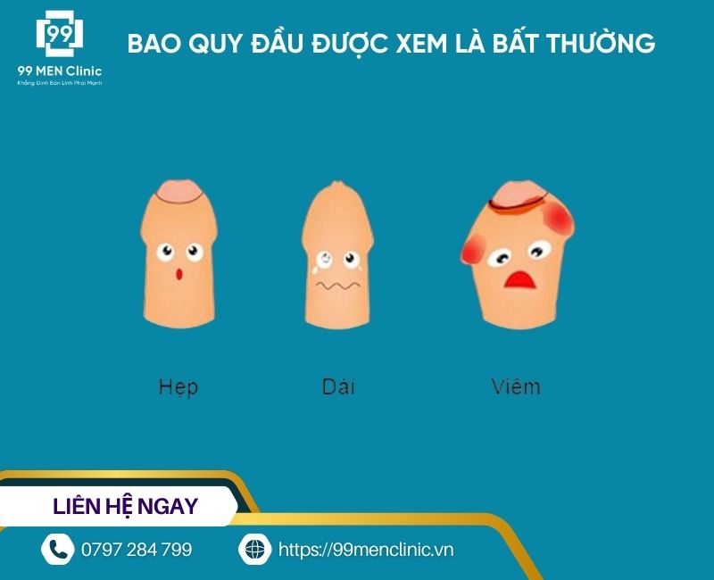 Bao quy đầu được xem là bất thường