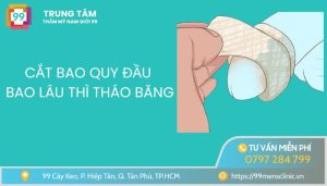 Cắt bao quy đầu bao lâu thì tháo băng