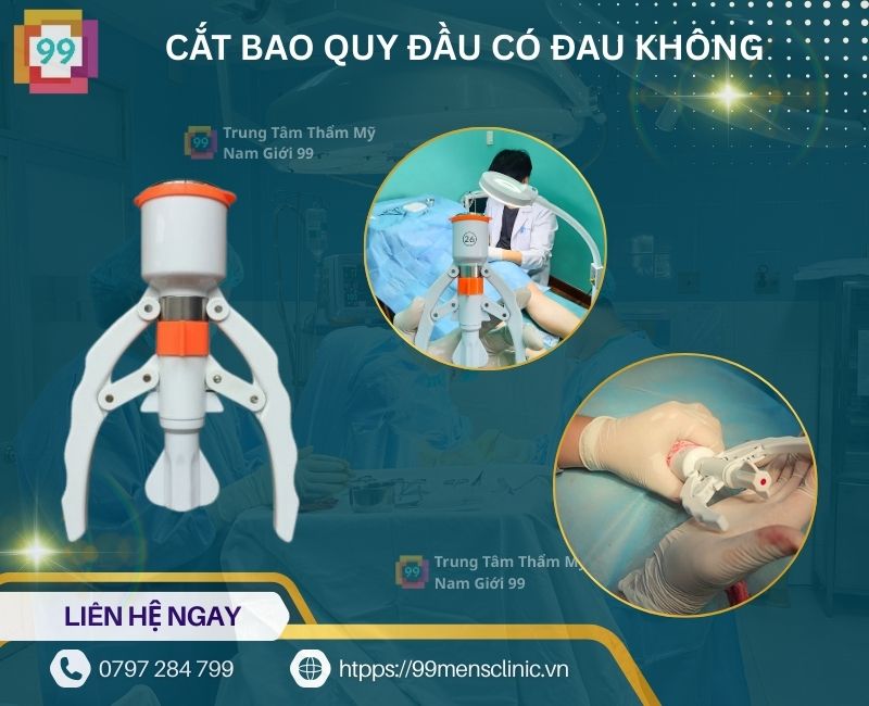 Cắt bao quy đầu xong có đau không