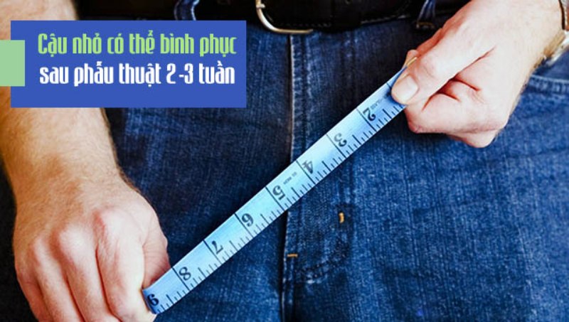 Thời gian lành phẫu thuật tăng kích thước cậu nhỏ 