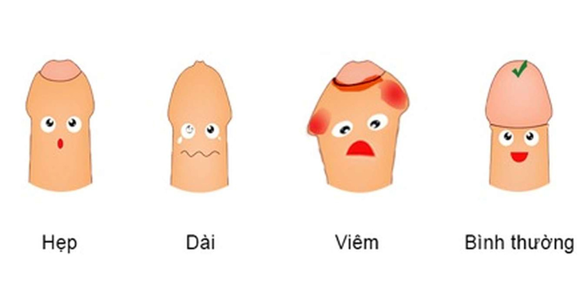 Tại sao phải cắt bao quy đầu ở Nam Giới?