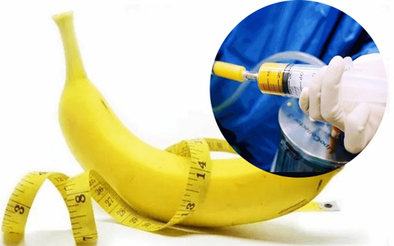 Chuyển mô mỡ tự thân cũng là cách tăng kích thước dương vật