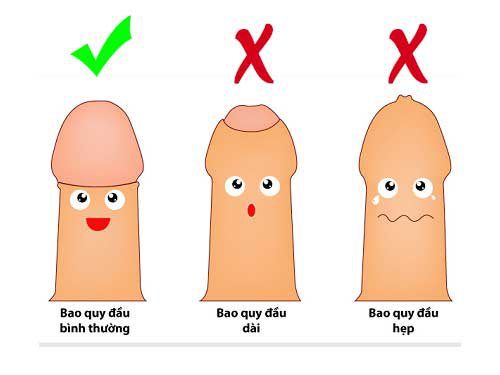 Tình trạng bao quy đầu ở Nam Giới