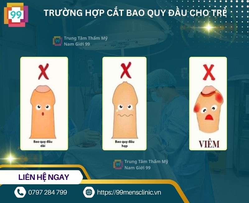 Trường hẹp cần cắt bao quy đầu cho bé