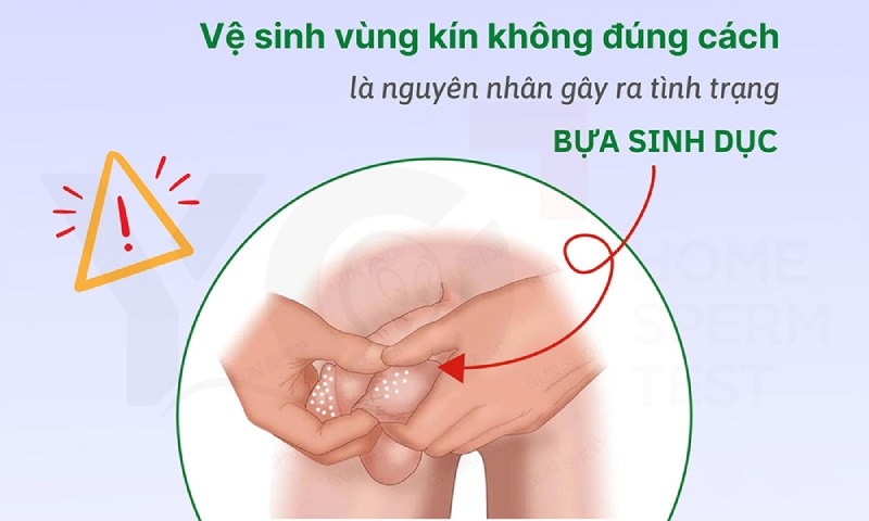 Vệ sinh cậu nhỏ không đúng cách có thể gây ra bựa sinh dục