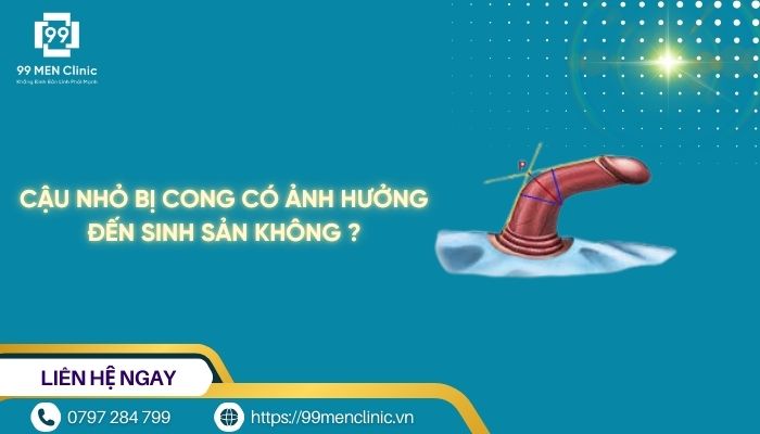 Cậu nhỏ bị cong có ảnh hưởng đến sinh sản không