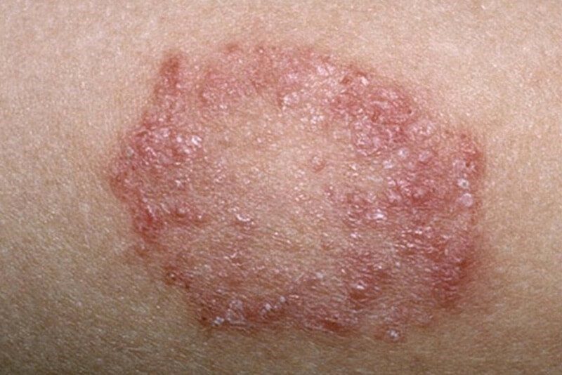 cậu nhỏ có đốm trắng