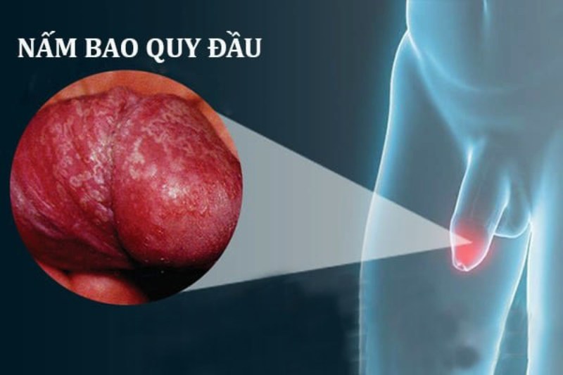 cậu nhỏ có đốm trắng
