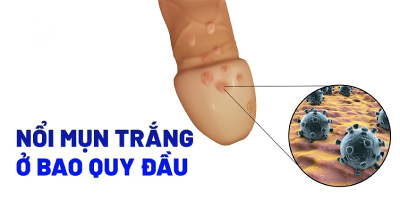 cậu nhỏ có đốm trắng