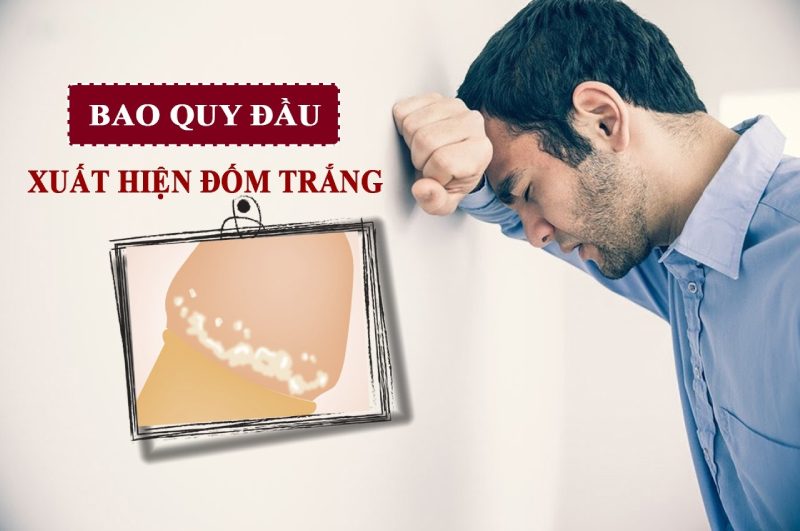 cậu nhỏ có đốm trắng