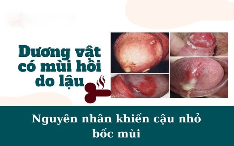 cậu nhỏ có mùi hôi