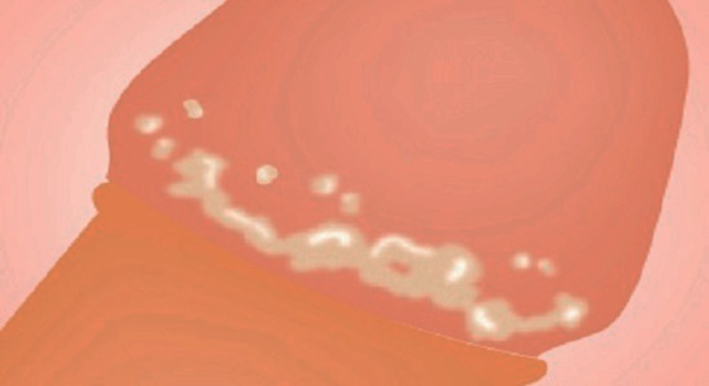 cậu nhỏ có mùi hôi