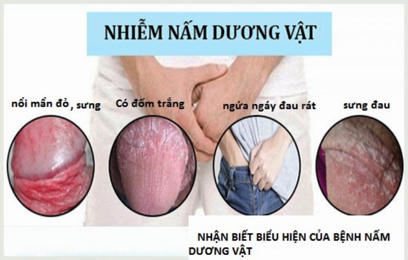 cậu nhỏ có mùi hôi