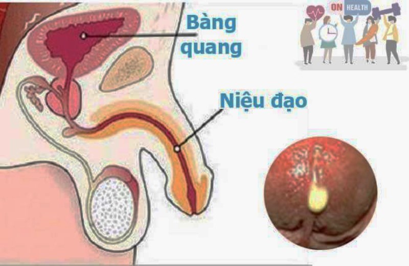 cậu nhỏ có mùi hôi