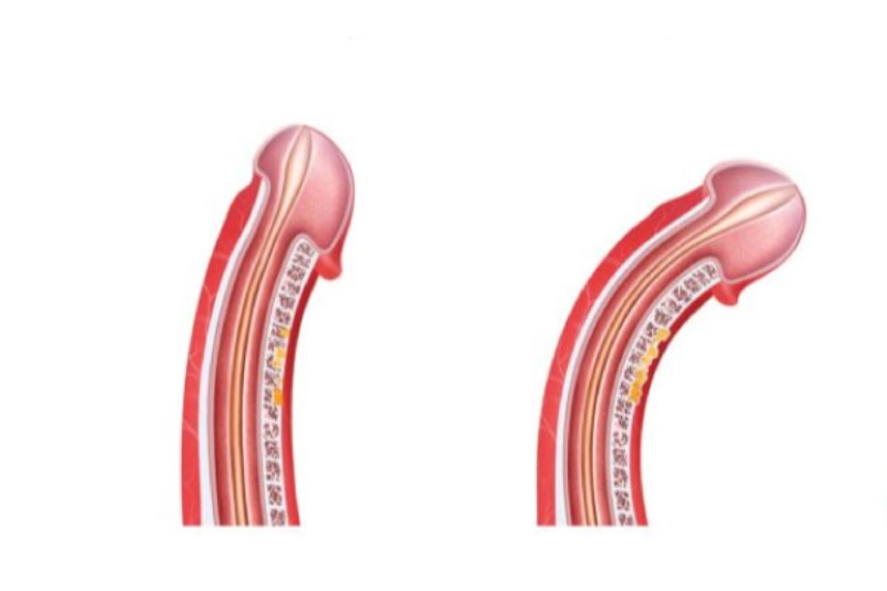 cậu nhỏ cong hay thẳng tốt hơn