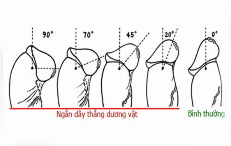 cậu nhỏ cong hay thẳng tốt hơn