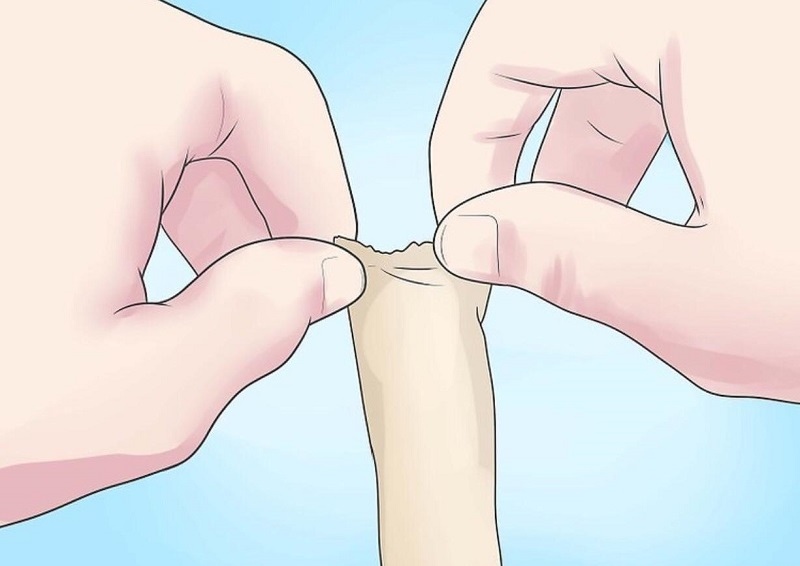 cậu nhỏ không phát triển ở tuổi dậy thì