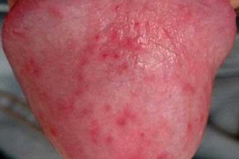 cậu nhỏ nổi mụn đỏ