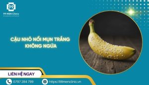 Cậu nhỏ nổi mụn trắng không ngứa