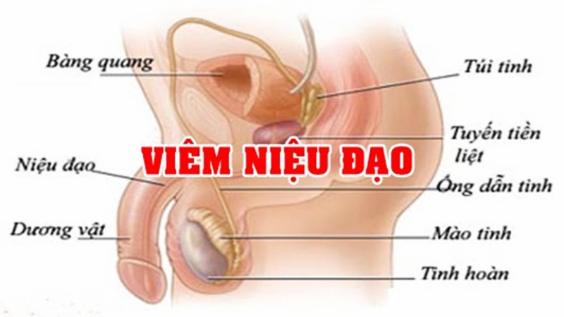 cậu nhỏ ra dịch trắng có nguy hiểm không