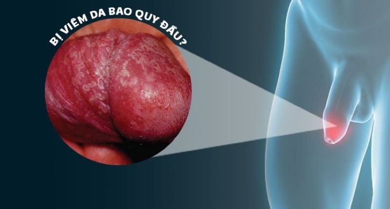 cậu nhỏ ra dịch trắng có nguy hiểm không