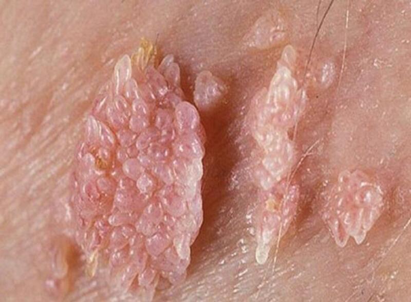 cậu nhỏ xuất hiện đốm đen