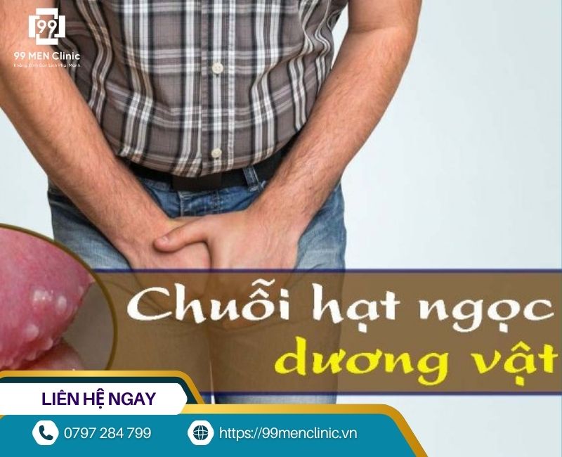 Mụn trắng do hạt ngọc dương vật gây ra