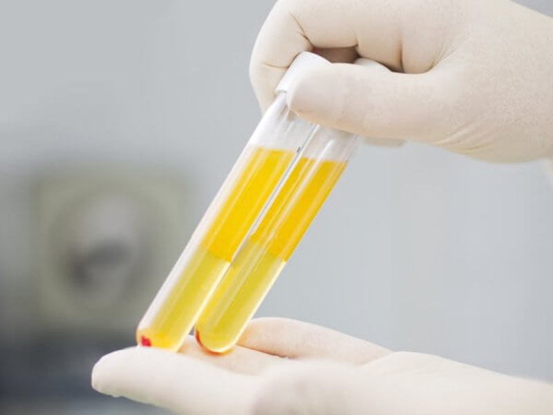 cậu nhỏ bị teo