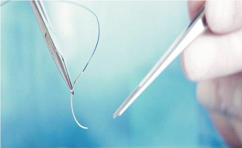 chữa trị xuất tinh sớm không cần thuốc