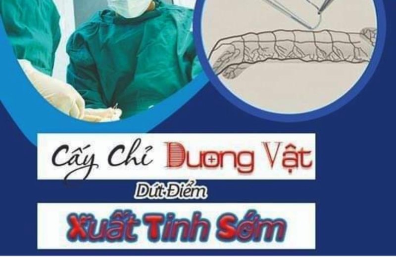 chữa xuất tinh sớm bằng phương pháp cấy chỉ