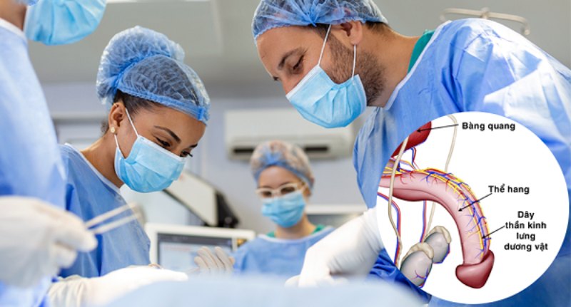 phẫu thuật trị xuất tinh sớm