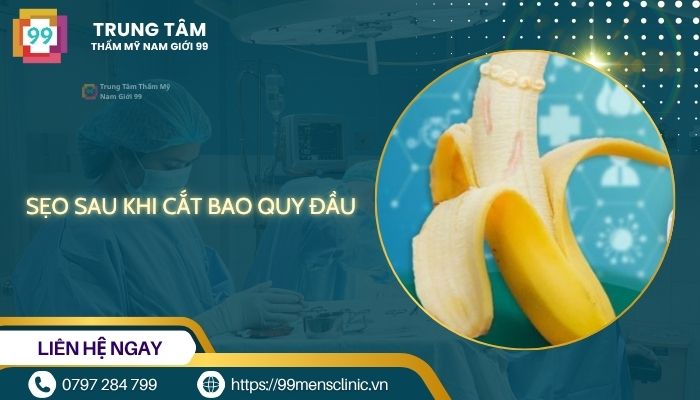 Sẹo sau khi cắt bao quy đầu