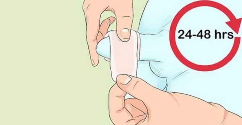 Với người lớn, sau khi cắt bao quy đầu nên vệ sinh đúng cách, tránh sờ nắn vết thương